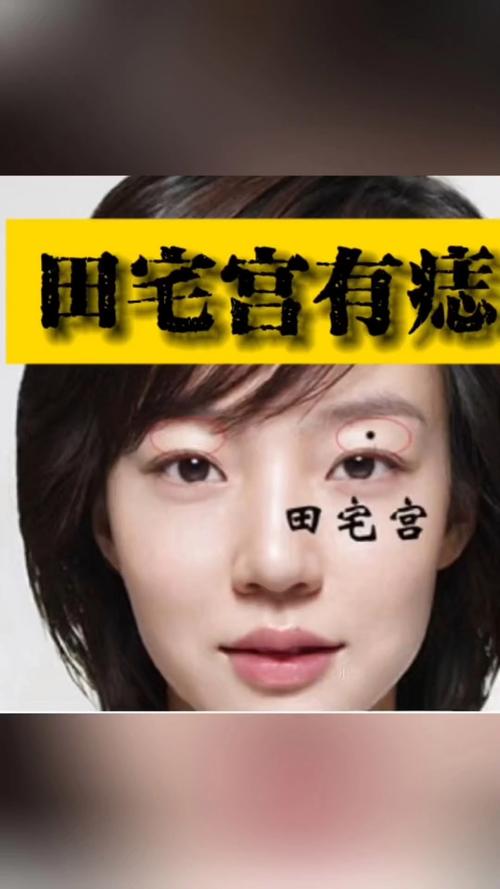 田宅宮長(zhǎng)痣代表什么 好不好