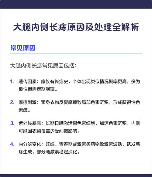 大腿內(nèi)側(cè)的痣有什么說法
