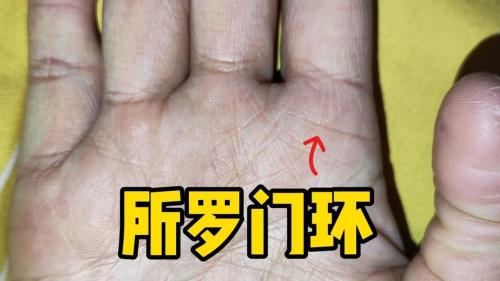 手掌中的輔助紋線——所羅門環
