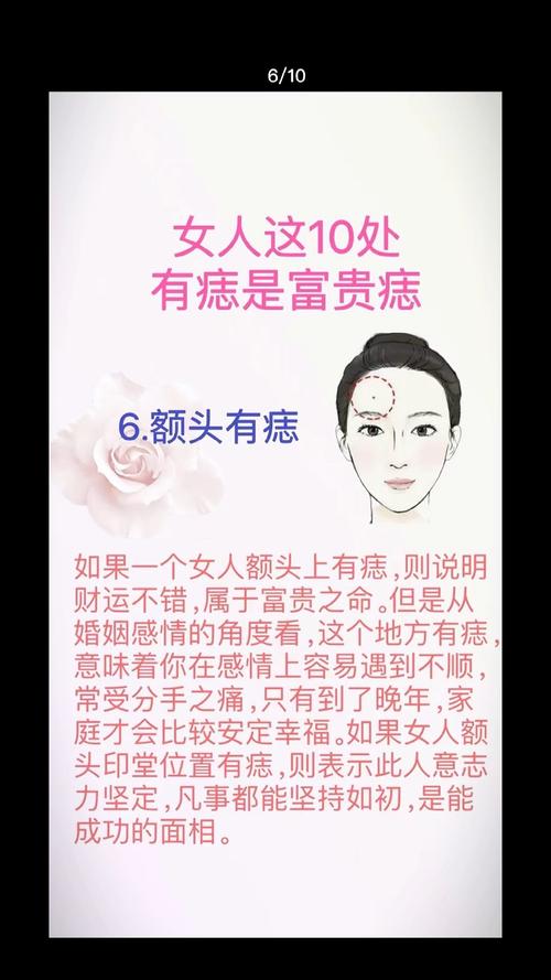 腦門有痣好不好