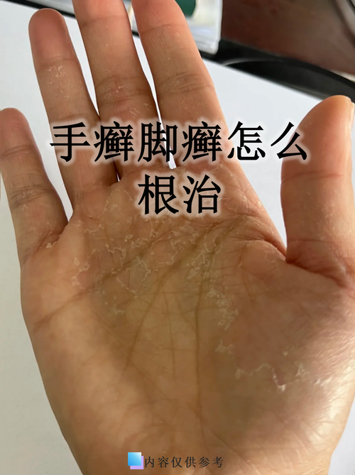 手和腳無緣無故發(fā)癢 財(cái)運(yùn)感情運(yùn)不穩(wěn)定