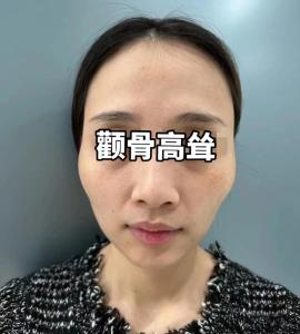 兩邊顴骨突出的面相好嗎？雷厲風(fēng)行，比較自我？