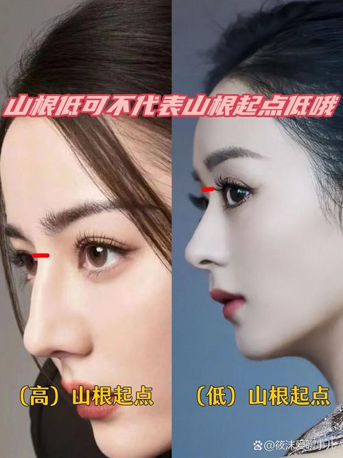 山根低意味著什么