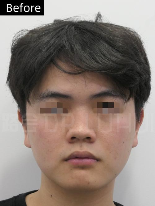 鼻梁扁的男人 不太自信缺乏長遠眼光