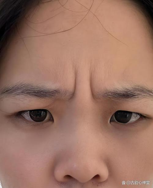 女人印堂有豎紋面相