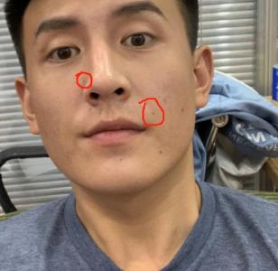 男人左邊法令紋有痣大富大貴
