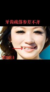牙齒稀疏的女人面相如何，需要多注意人際關系？