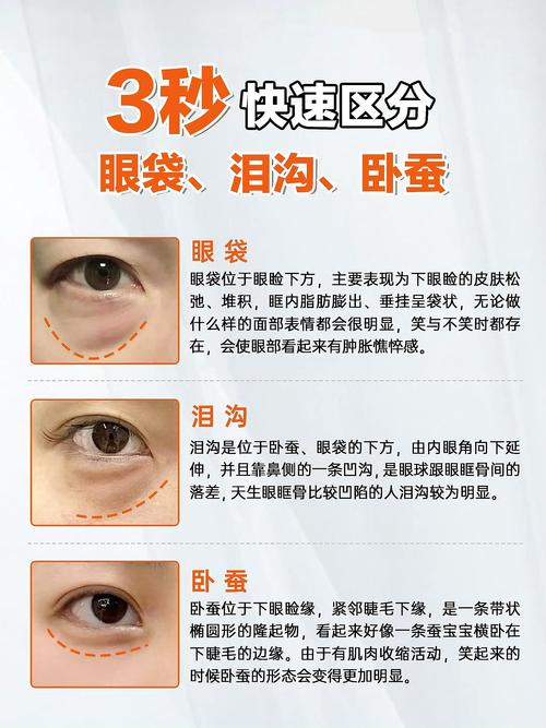 臥蠶眼和眼袋對比圖，教你看明白