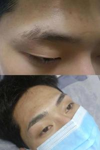 眉毛上有疤的人命運