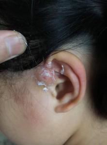 耳朵上有個小眼有福氣