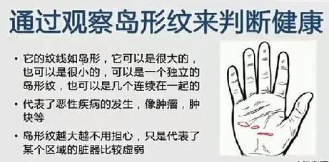 手相島紋和鏈紋的區(qū)別：形態(tài)和含義都有所不同！