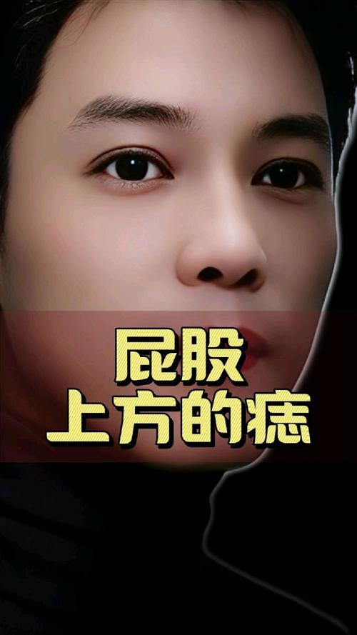 女人少見的極富貴痣屁股痣