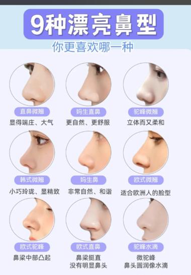 朝天鼻好還是不好