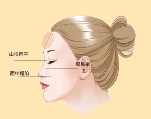 女人額頭扁平面相好嗎