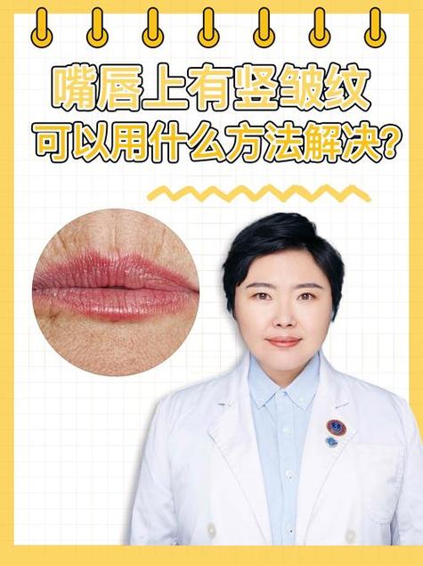 嘴唇有豎紋代表著什么