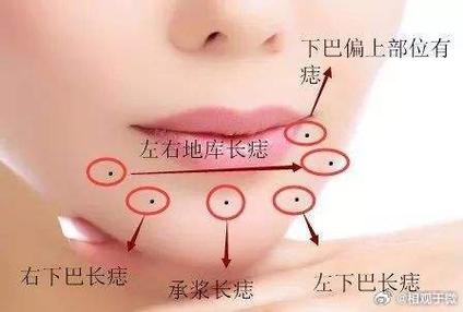 最有橫財的痣左下巴