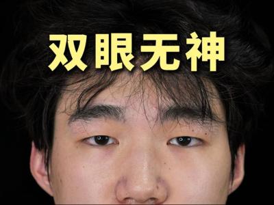 雙目無神的人的面相如何