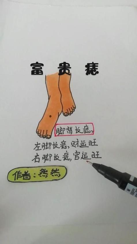 男人腳背長痣代表什么含義