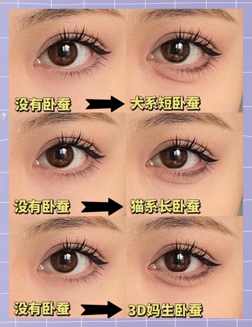 什么是臥蠶眼 有什么說法