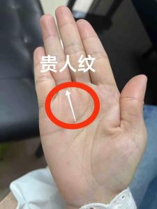貴人紋在哪個位置好 財運上漲迅猛好運到來