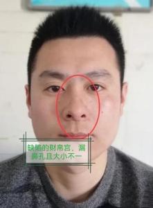 歪鼻的人財不旺嗎