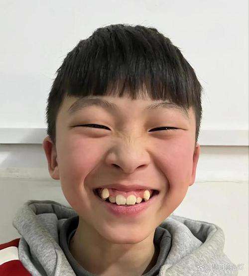 男生長虎牙有福氣嗎