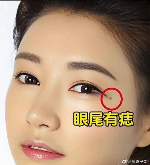 女生狐貍痣