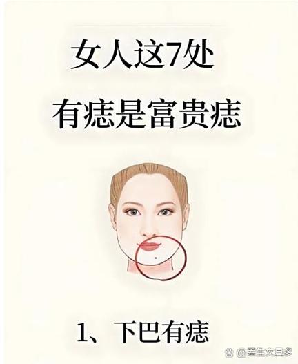 頂級富貴痣眼角有痣好嗎