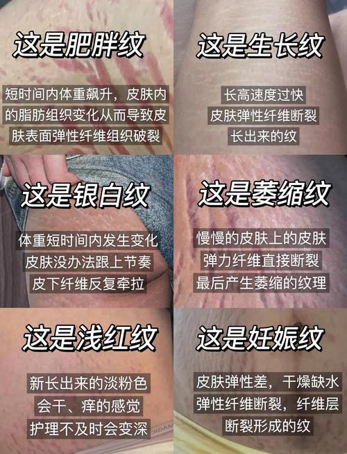 不測紋會帶來霉運嗎