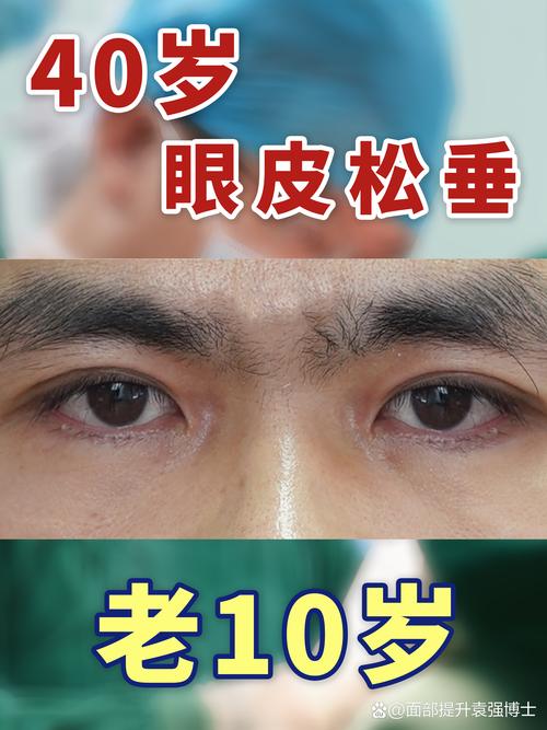 眼角下垂的人是典型的工作狂、過勞族？