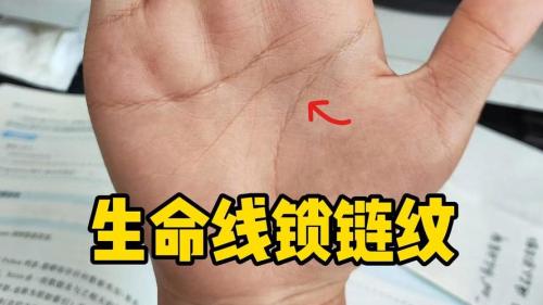 三條都是鎖鏈狀的手相  遇事需要冷靜