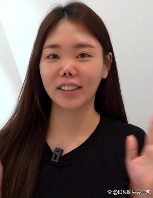 女人鼻子有點(diǎn)歪的命運(yùn)