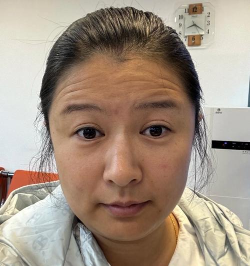 女人抬頭紋多命苦嗎 命運(yùn)如何