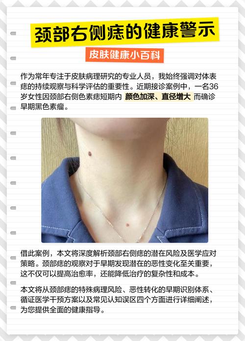 男人脖子右邊有痣代表什么