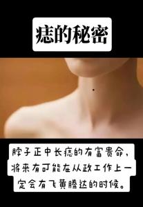 脖頸痣的位置與命運 脖子前邊長痣獨斷專行