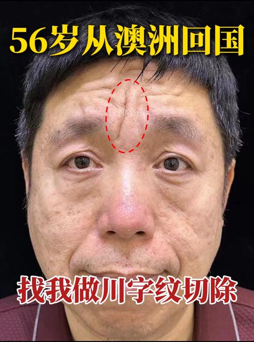你的額頭紋會讓你事業(yè)有成嗎？