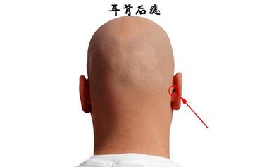 耳朵后面頭皮上痣相法