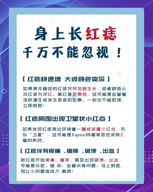紅痣代表什么命運 好不好