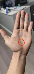 手相生命線出現(xiàn)分叉就預(yù)示著會(huì)生大病嗎？