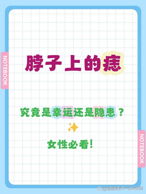 女人脖子上有痣好不好 不同位置代表什么