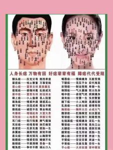 鼻梁上有痣代表什么