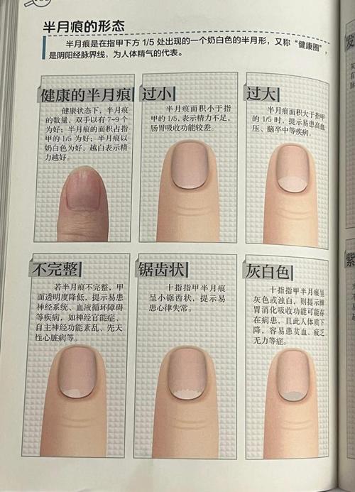 手相半月痕看你身體健康