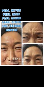 有懸針紋的女人要怎么做才能轉運