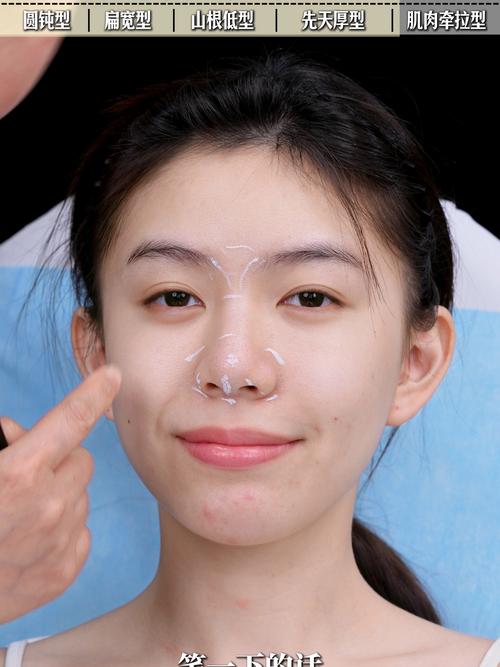 鼻頭肉多的女生