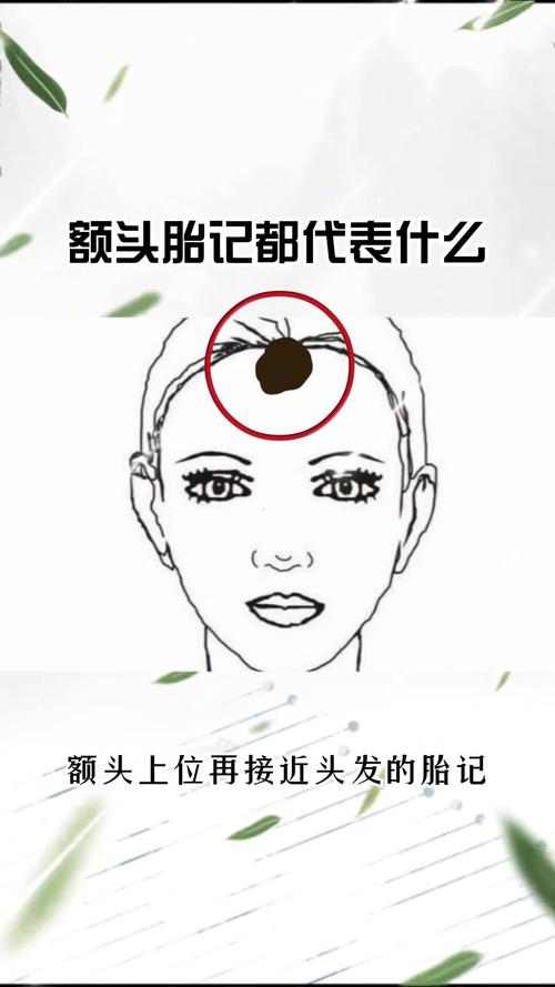 詳解：額頭上有胎記預示著什么？