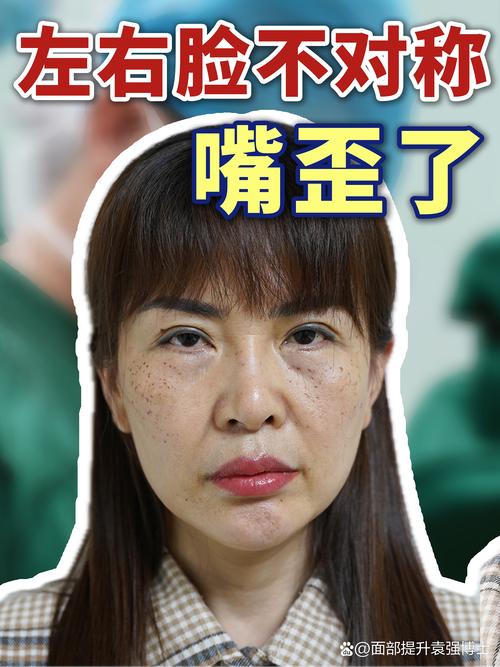 左右臉不對稱意味著什么？