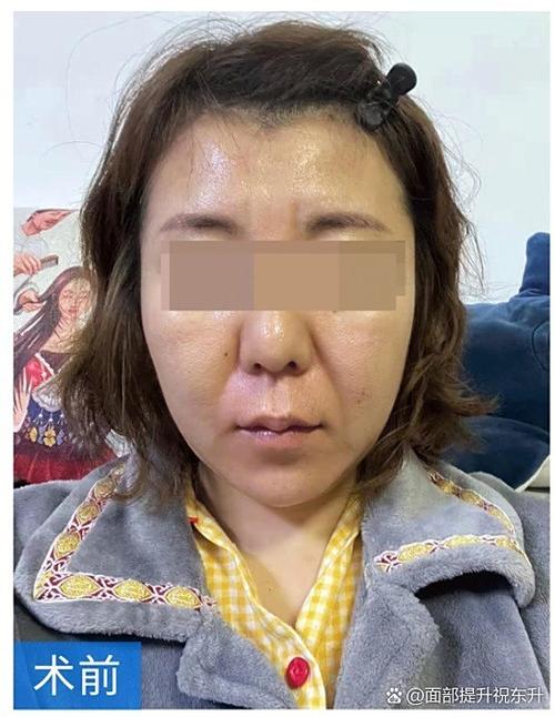 臉越來越圓是要來好運(yùn)嗎 福報增加后臉變圓潤嗎