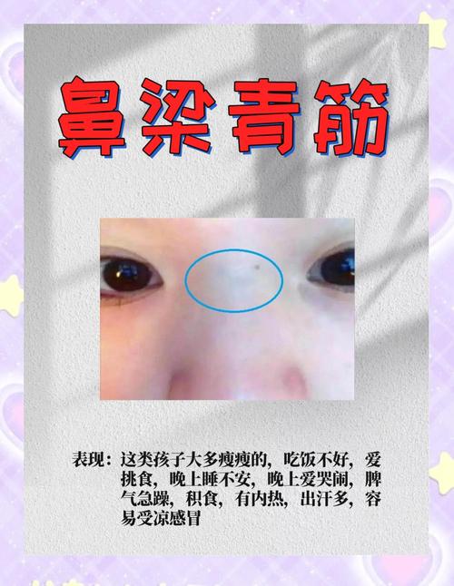 鼻子上有青筋的人命運(yùn)