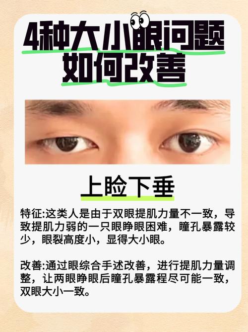男生大小眼對婚姻有何影響呢