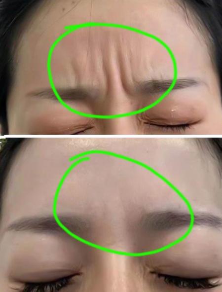 女人福針紋什么樣子